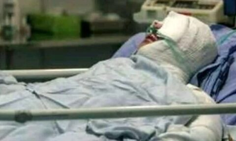 هیچگونه بیمارستان استانداردی حتی در تهران برای بیماران سوختگی