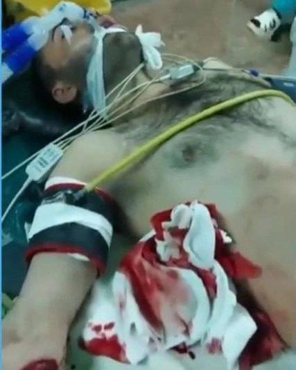 جراحت شدید یک کولبر بر اثر اصابت گلوله نیروهای نظامی در مرز سردشت