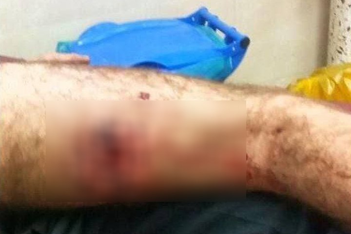 زخمی شدن یک کودک کولبر در نوار مرزی نوسود